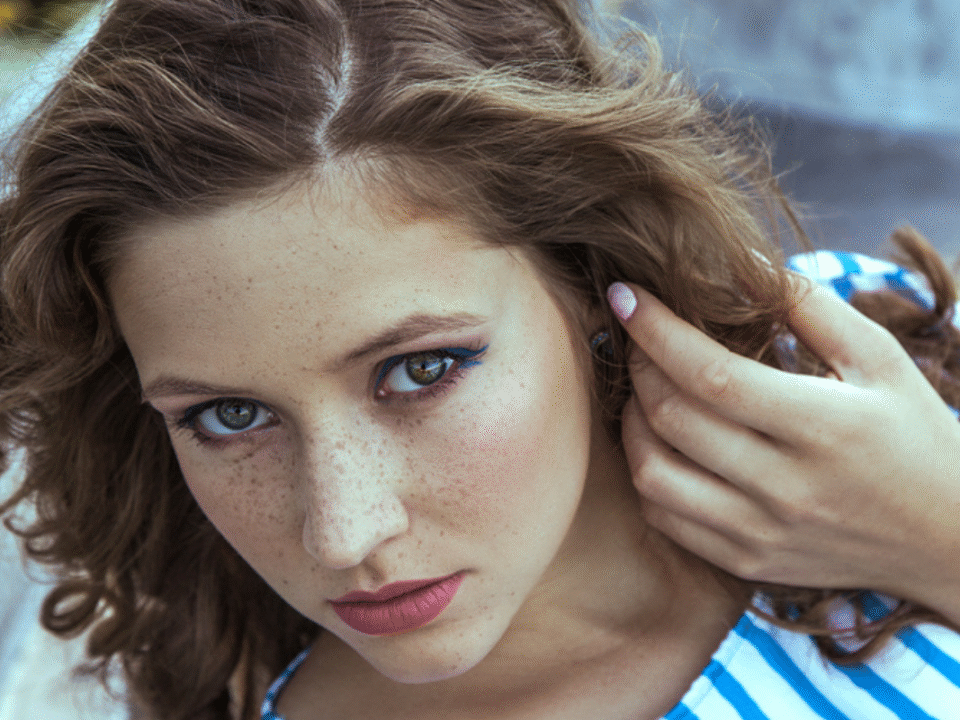 How to Remove Sunspots on Your Face