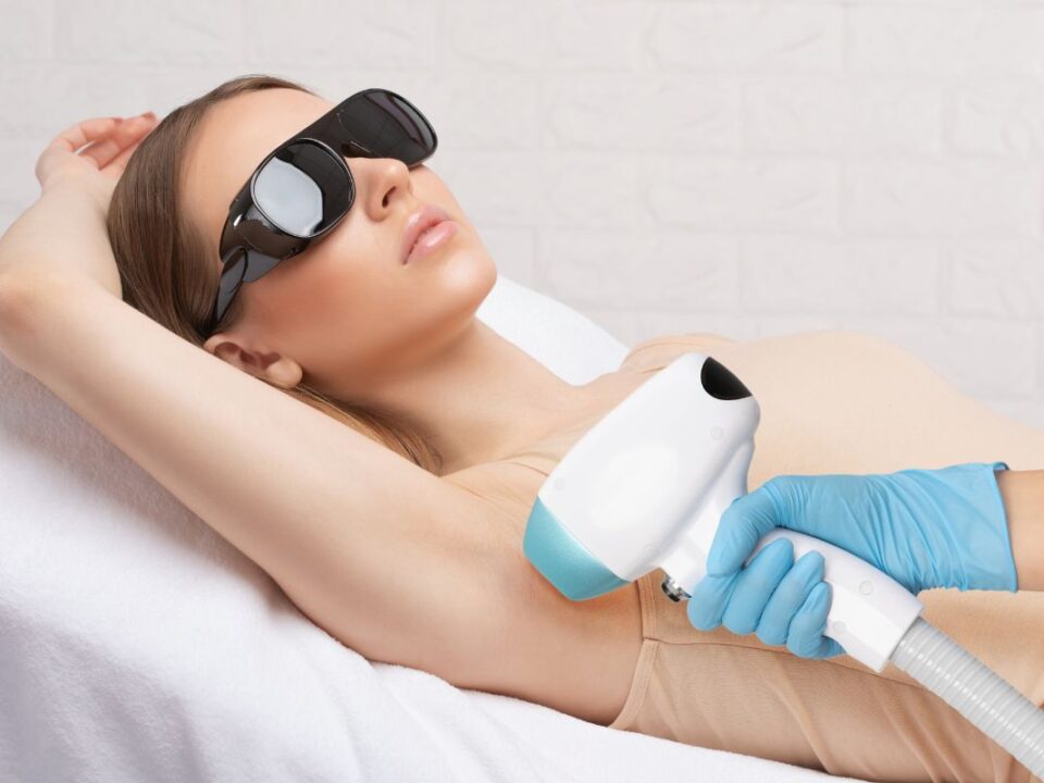 how to prepare for laser hair removal