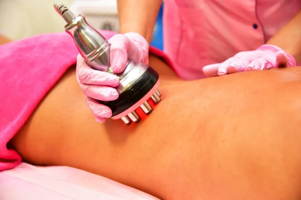 Non Surgical Body Sculpting-Risks of Nonsurgical Body Sculpting