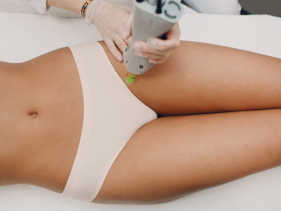 Bikini Laser Hair Removal: The Important Facts You Need to Know