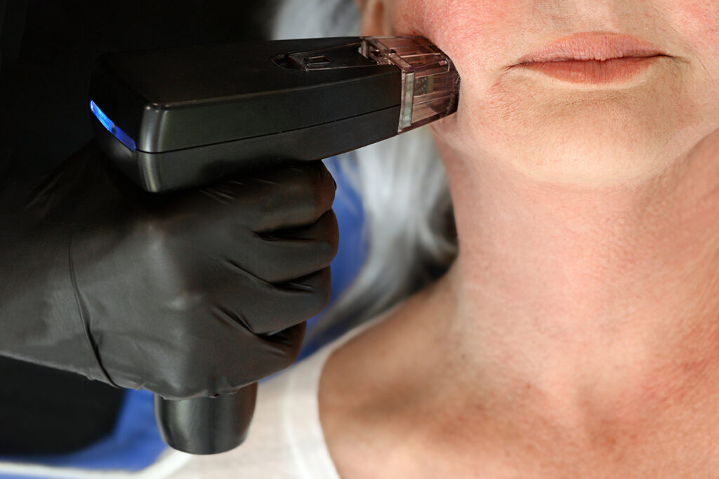 ultherapy vs morpheus8-Head‑to‑Head Comparison (And Even vs Other Treatments Like Thermage)