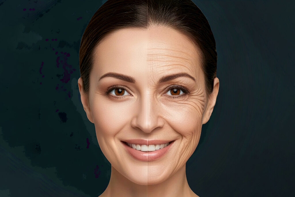 Dermal Fillers for Ozempic Face-Dermal Fillers for Ozempic Face